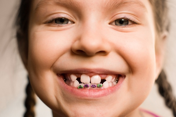 Orthodontic treatment for adults and children | Evolution Dental | Calgary